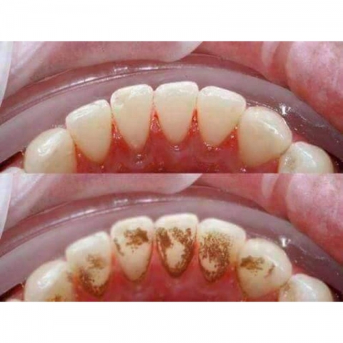 Nước súc miệng Propolinse 600ml tẩy ố răng -tẩy trắng răng hàng Nhật