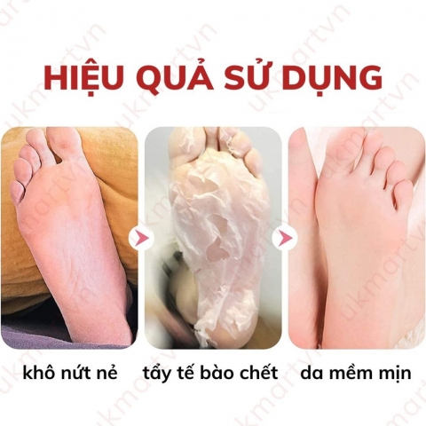Ủ Da Chết Bàn Chân To Plan Hàng Nhật
