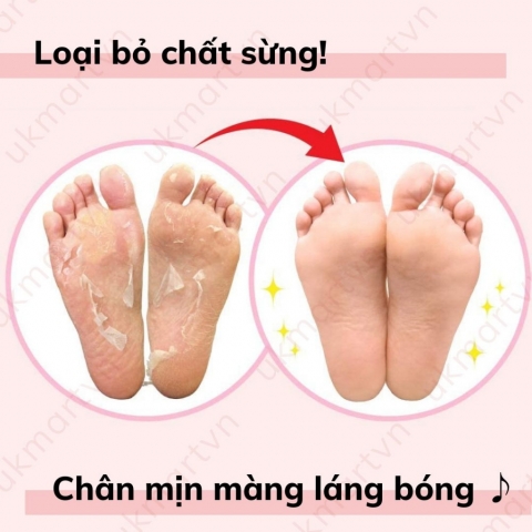 Ủ Da Chết Bàn Chân To Plan Hàng Nhật